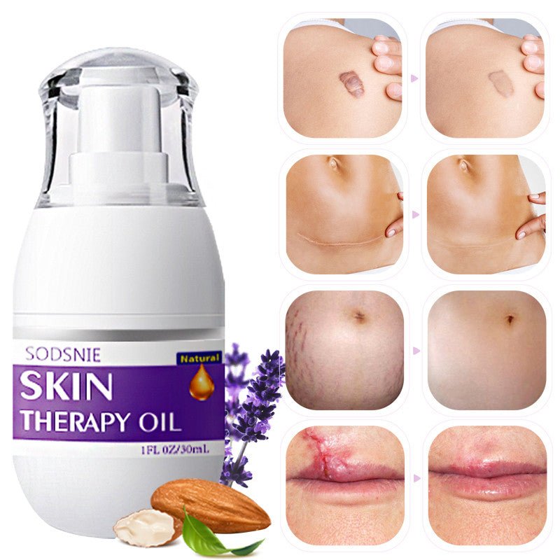 Skin Treatment Oil Remove Puncture Cellulite Stretch Mark Repair Body Care 30ml - Body Bliss Essentials