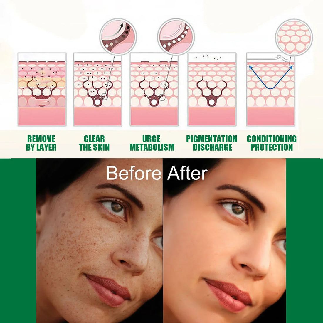 Whitening Freckle Serum Fade Pigmentation Moisturizing Face Care Essence