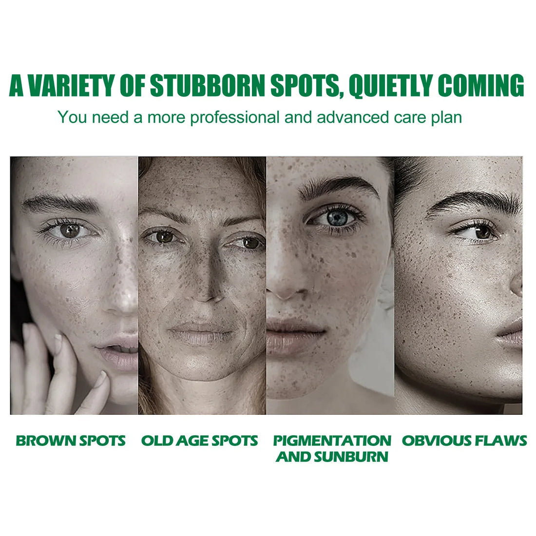 Whitening Freckle Serum Fade Pigmentation Moisturizing Face Care Essence