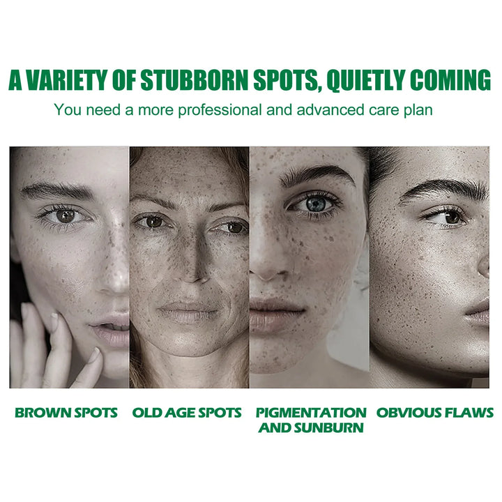 Whitening Freckle Serum Fade Pigmentation Moisturizing Face Care Essence