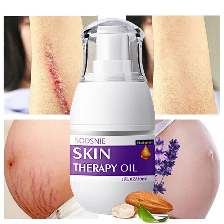 Skin Treatment Oil Remove Puncture Cellulite Stretch Mark Repair Body Care 30ml - Body Bliss Essentials
